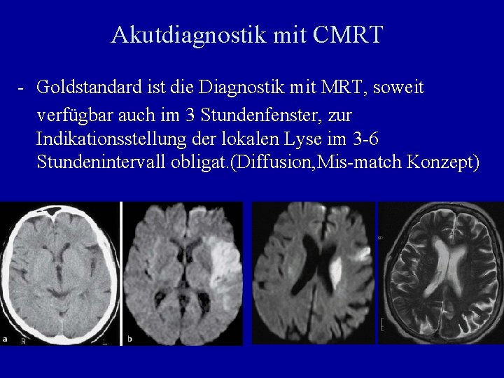 Akutdiagnostik mit CMRT - Goldstandard ist die Diagnostik mit MRT, soweit verfügbar auch im
