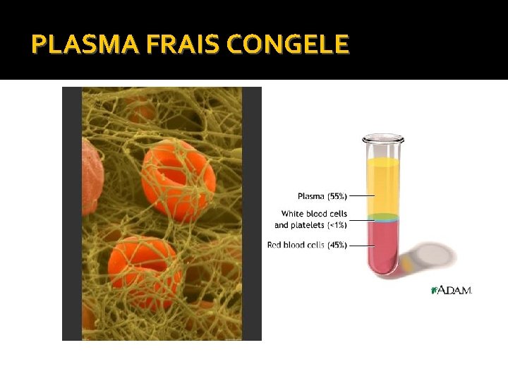 PLASMA FRAIS CONGELE PLASMA FRAIS CONGELE