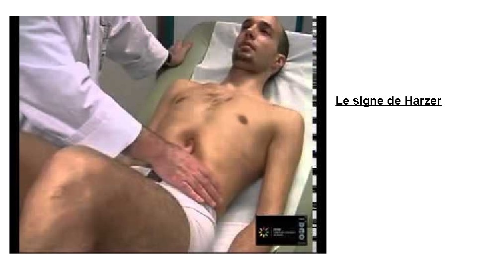 Le signe de Harzer Le signe de Harzer