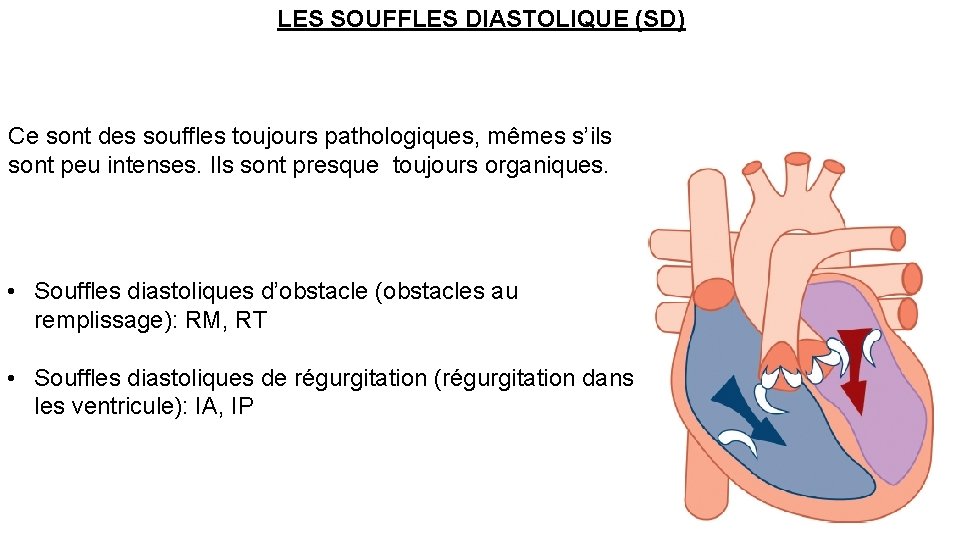 LES SOUFFLES DIASTOLIQUE (SD) Ce sont des souffles toujours pathologiques, mêmes s’ils sont peu