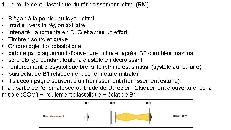 1. Le roulement diastolique du rétrécissement mitral (RM) • Siège : à la pointe,