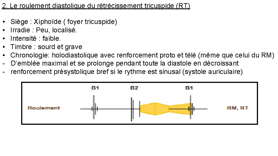 2. Le roulement diastolique du rétrécissement tricuspide (RT) • • • - Siège :