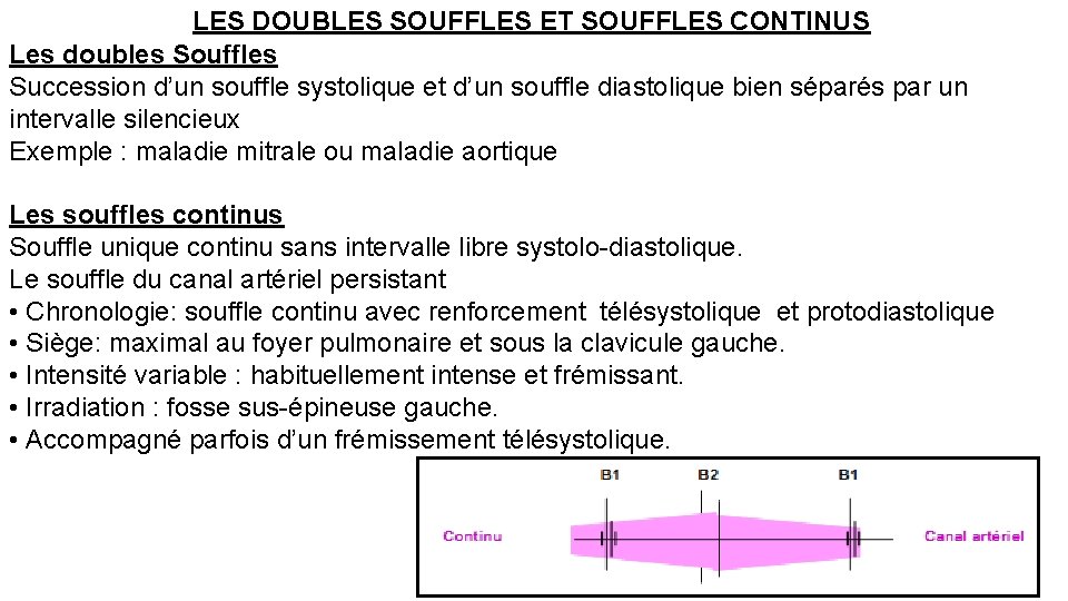 LES DOUBLES SOUFFLES ET SOUFFLES CONTINUS Les doubles Souffles Succession d’un souffle systolique et