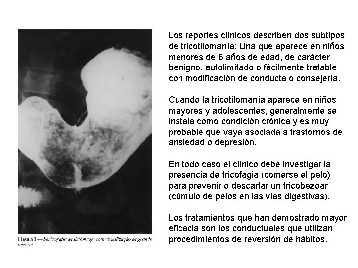 Los reportes clínicos describen dos subtipos de tricotilomanía: Una que aparece en niños menores