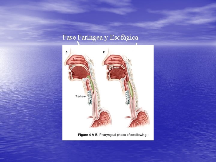 Fase Faríngea y Esofágica Fase Faríngea y Esofágica