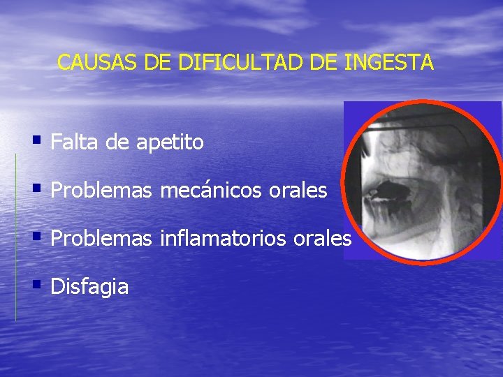 CAUSAS DE DIFICULTAD DE INGESTA § Falta de apetito § Problemas mecánicos orales § CAUSAS DE DIFICULTAD DE INGESTA § Falta de apetito § Problemas mecánicos orales §
