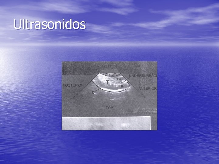 Ultrasonidos Ultrasonidos