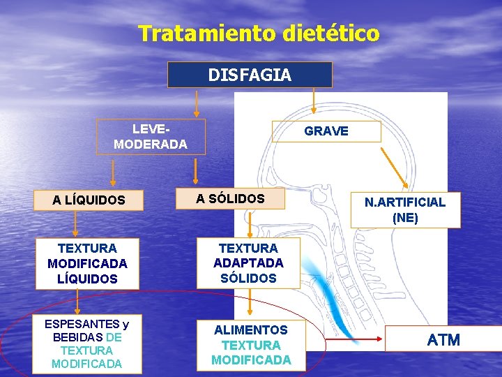 Tratamiento dietético DISFAGIA LEVEMODERADA A LÍQUIDOS GRAVE A SÓLIDOS TEXTURA MODIFICADA LÍQUIDOS TEXTURA ADAPTADA Tratamiento dietético DISFAGIA LEVEMODERADA A LÍQUIDOS GRAVE A SÓLIDOS TEXTURA MODIFICADA LÍQUIDOS TEXTURA ADAPTADA