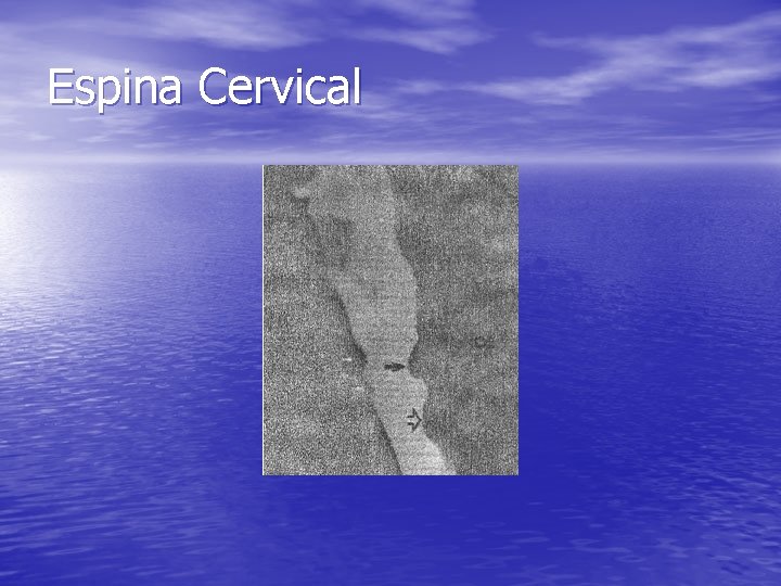 Espina Cervical Espina Cervical