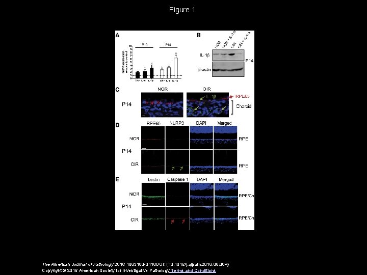 Figure 1 The American Journal of Pathology 2016 1863100 -3116 DOI: (10. 1016/j. ajpath.