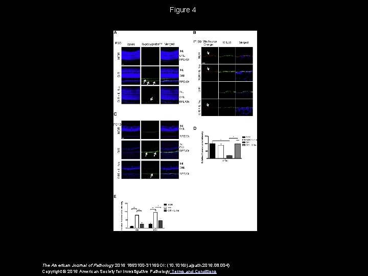 Figure 4 The American Journal of Pathology 2016 1863100 -3116 DOI: (10. 1016/j. ajpath.