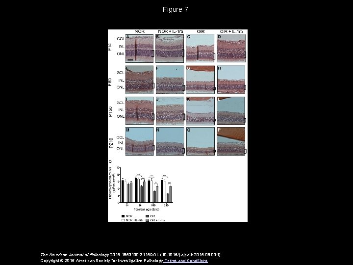 Figure 7 The American Journal of Pathology 2016 1863100 -3116 DOI: (10. 1016/j. ajpath.