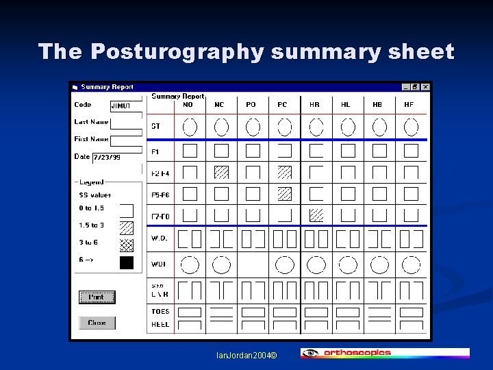 The Posturography summary sheet Ian. Jordan 2004© 