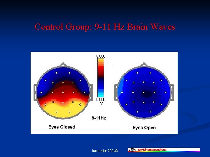 Control Group: 9 -11 Hz Brain Waves Ian. Jordan 2004© 