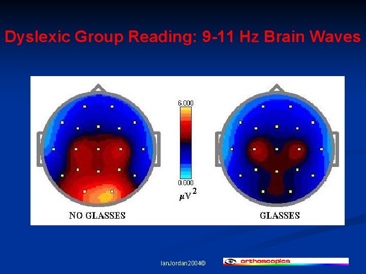 Dyslexic Group Reading: 9 -11 Hz Brain Waves Ian. Jordan 2004© 