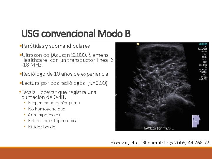 USG convencional Modo B §Parótidas y submandibulares §Ultrasonido (Acuson S 2000, Siemens Healthcare) con