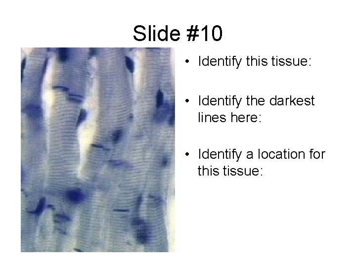 Slide #10 • Identify this tissue: • Identify the darkest lines here: • Identify