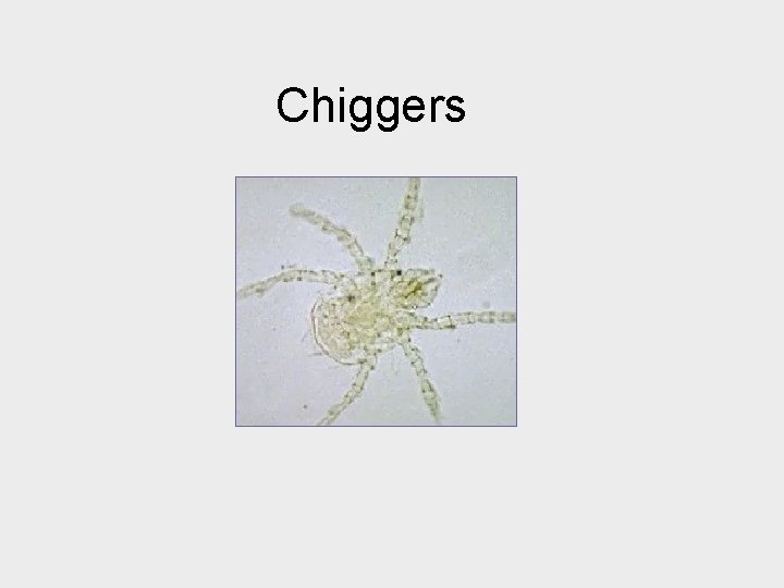Chiggers 