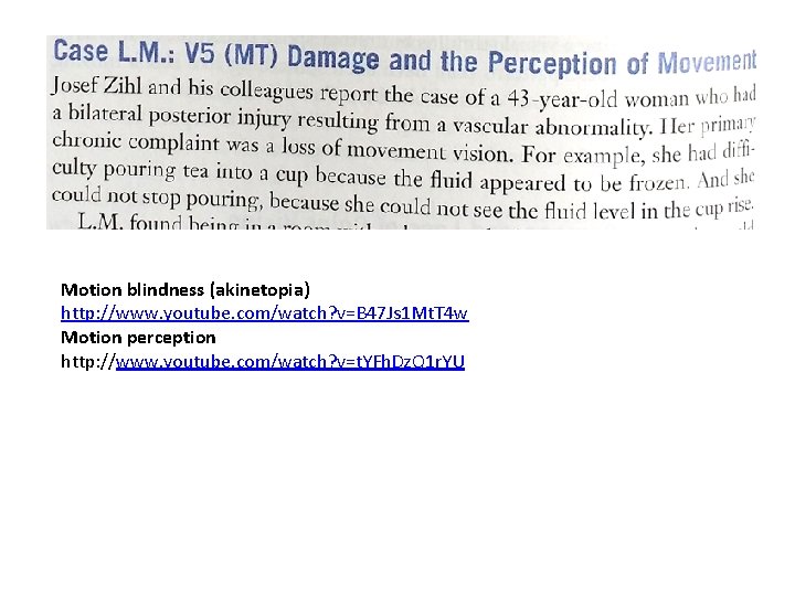 Motion blindness (akinetopia) http: //www. youtube. com/watch? v=B 47 Js 1 Mt. T 4 Motion blindness (akinetopia) http: //www. youtube. com/watch? v=B 47 Js 1 Mt. T 4