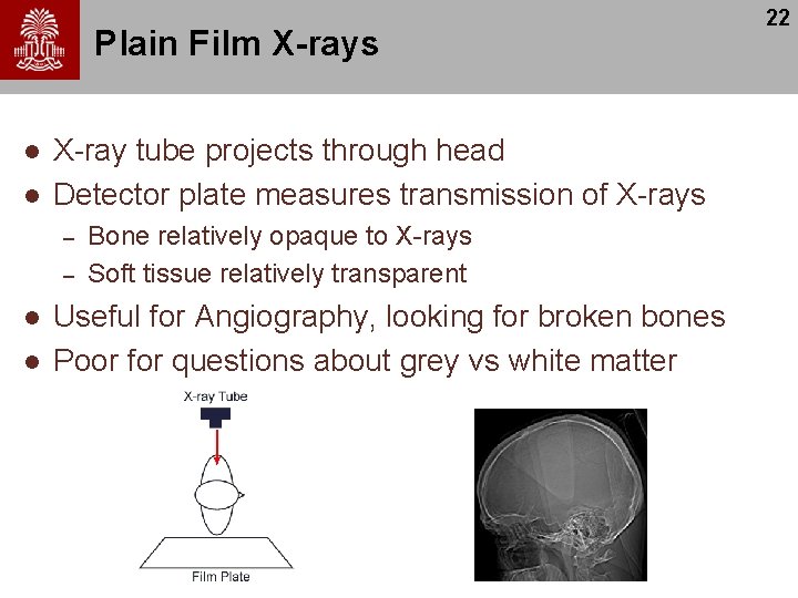 Plain Film X-rays l l X-ray tube projects through head Detector plate measures transmission