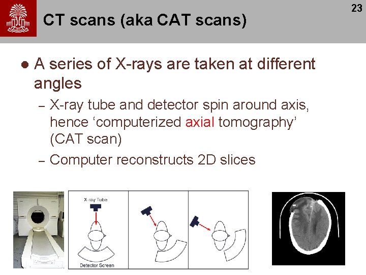 CT scans (aka CAT scans) l A series of X-rays are taken at different