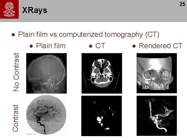25 XRays l Plain film vs computerized tomography (CT) Contrast No Contrast l Plain