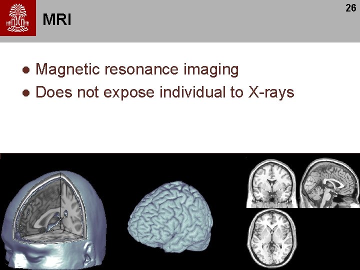 MRI Magnetic resonance imaging l Does not expose individual to X-rays l 26 