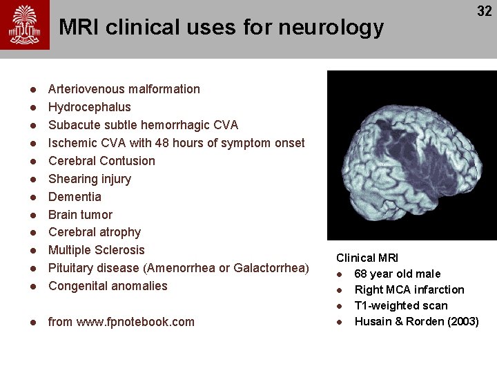 MRI clinical uses for neurology l Arteriovenous malformation Hydrocephalus Subacute subtle hemorrhagic CVA Ischemic