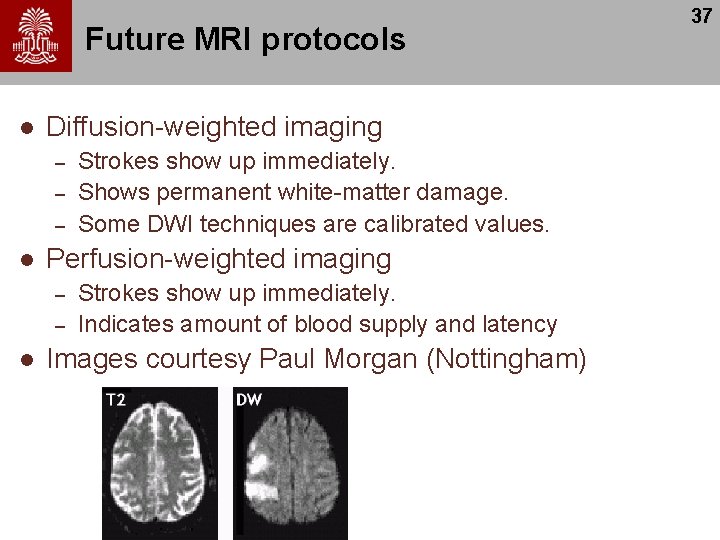 Future MRI protocols l Diffusion-weighted imaging – – – l Perfusion-weighted imaging – –