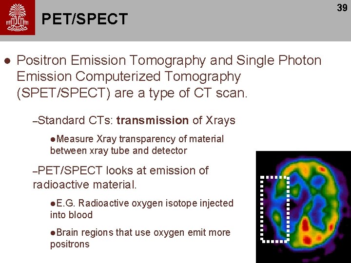 PET/SPECT l Positron Emission Tomography and Single Photon Emission Computerized Tomography (SPET/SPECT) are a