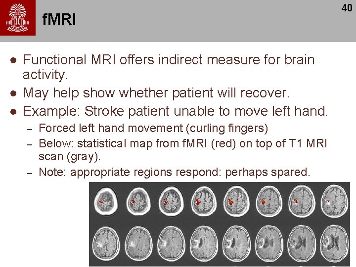 f. MRI l l l Functional MRI offers indirect measure for brain activity. May