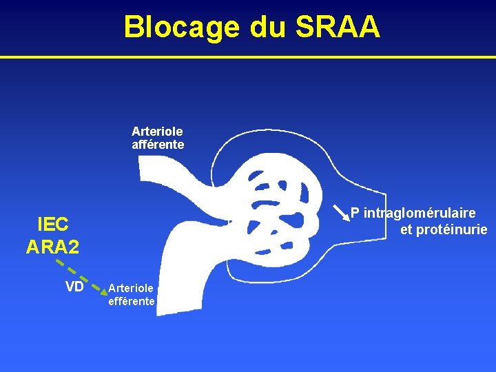 Blocage du SRAA Arteriole afférente P intraglomérulaire et protéinurie IEC ARA 2 VD Arteriole
