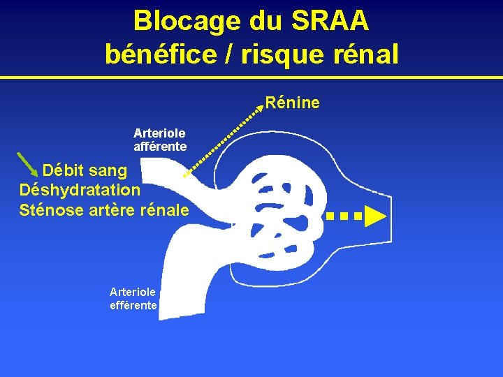 Blocage du SRAA bénéfice / risque rénal Rénine Arteriole afférente Débit sang Déshydratation Sténose