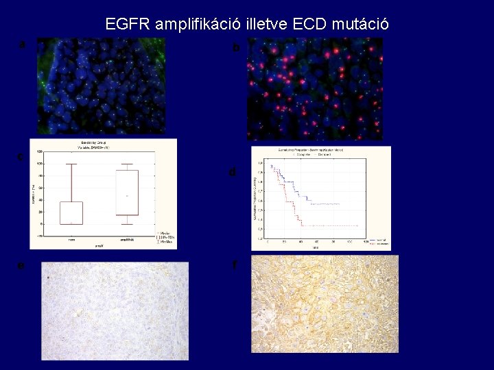 EGFR amplifikáció illetve ECD mutáció a b c d e f 