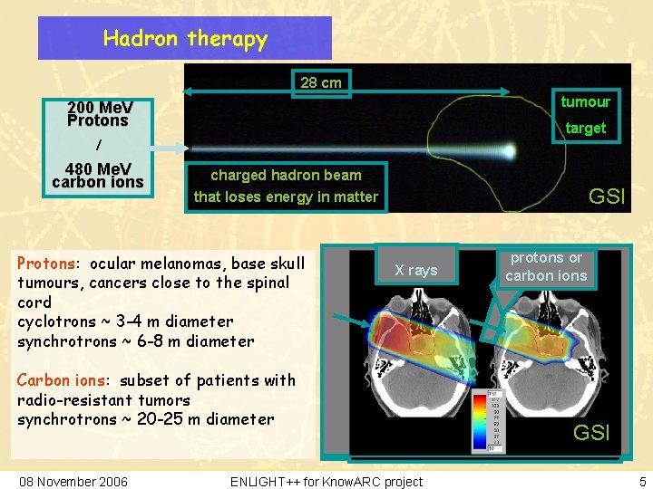 Hadron therapy 28 cm tumour 200 Me. V Protons target / 480 Me. V