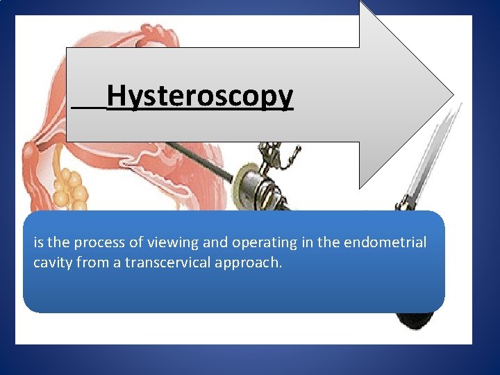 Hysteroscopy is the process of viewing and operating in the endometrial cavity from a