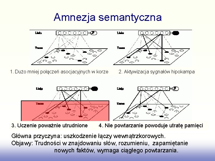 Amnezja semantyczna 1. Dużo mniej połączeń asocjacyjnych w korze 3. Uczenie poważnie utrudnione 2.