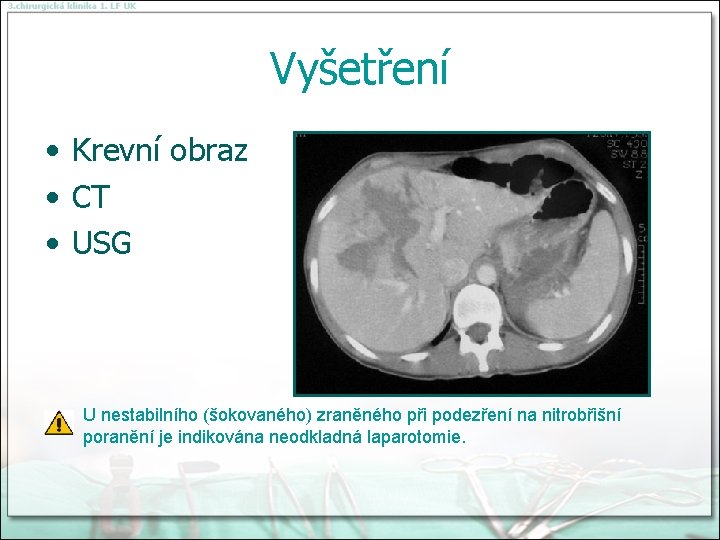 Vyšetření • Krevní obraz • CT • USG U nestabilního (šokovaného) zraněného při podezření