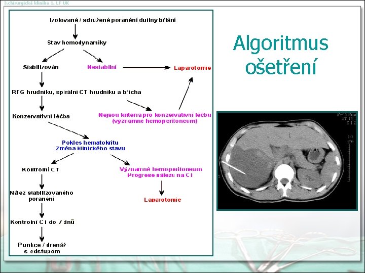 Algoritmus ošetření 