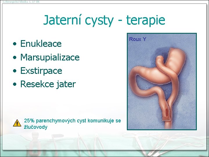 Jaterní cysty - terapie • • Enukleace Marsupializace Exstirpace Resekce jater 25% parenchymových cyst