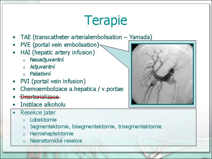 Terapie • TAE (transcatheter arterialembolisation – Yamada) • PVE (portal vein embolisation) • HAI