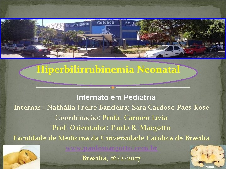 Hiperbilirrubinemia Neonatal Internato em Pediatria Internas : Nathália Freire Bandeira; Sara Cardoso Paes Rose