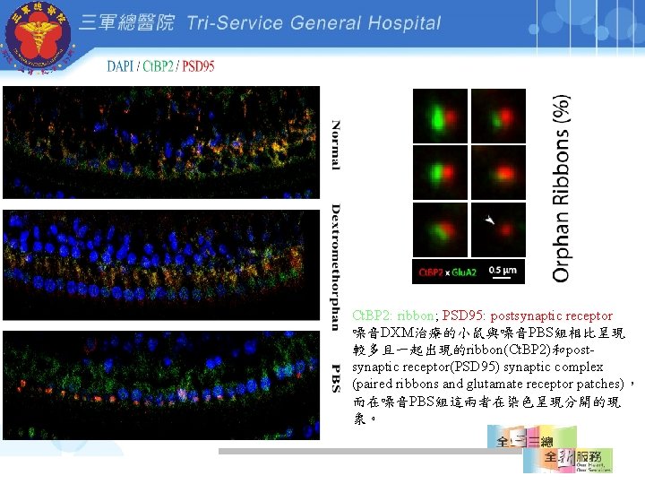 Ct. BP 2: ribbon; PSD 95: postsynaptic receptor 噪音DXM治療的小鼠與噪音PBS組相比呈現 較多且一起出現的ribbon(Ct. BP 2)和postsynaptic receptor(PSD 95)