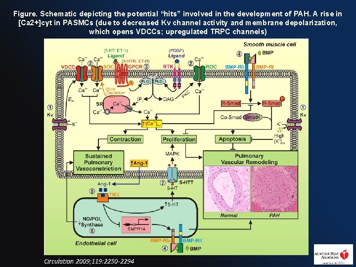 Figure. Schematic depicting the potential “hits” involved in the development of PAH. A rise