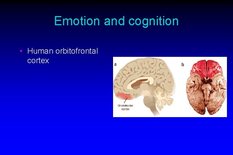 Emotion and cognition • Human orbitofrontal cortex 