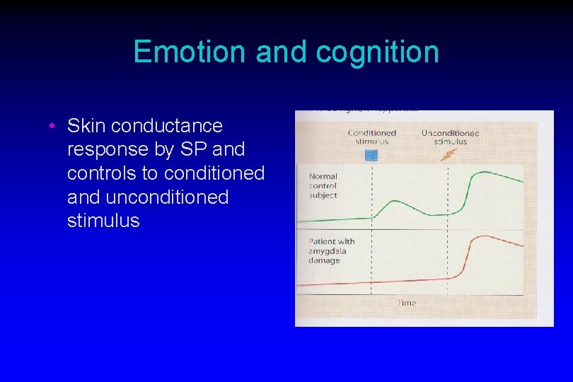 Emotion and cognition • Skin conductance response by SP and controls to conditioned and