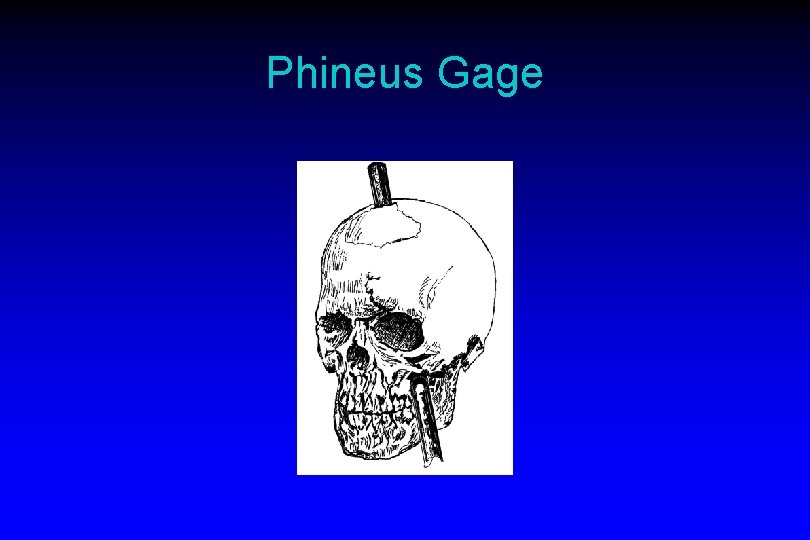 Phineus Gage 