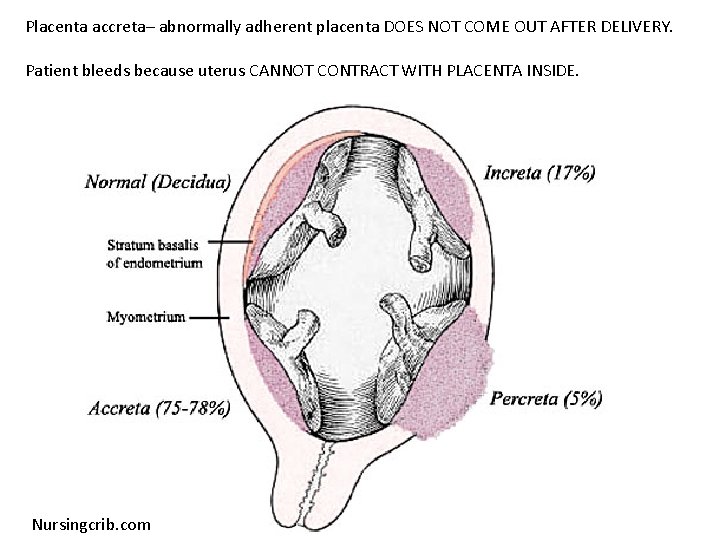 Placenta accreta– abnormally adherent placenta DOES NOT COME OUT AFTER DELIVERY. Patient bleeds because Placenta accreta– abnormally adherent placenta DOES NOT COME OUT AFTER DELIVERY. Patient bleeds because