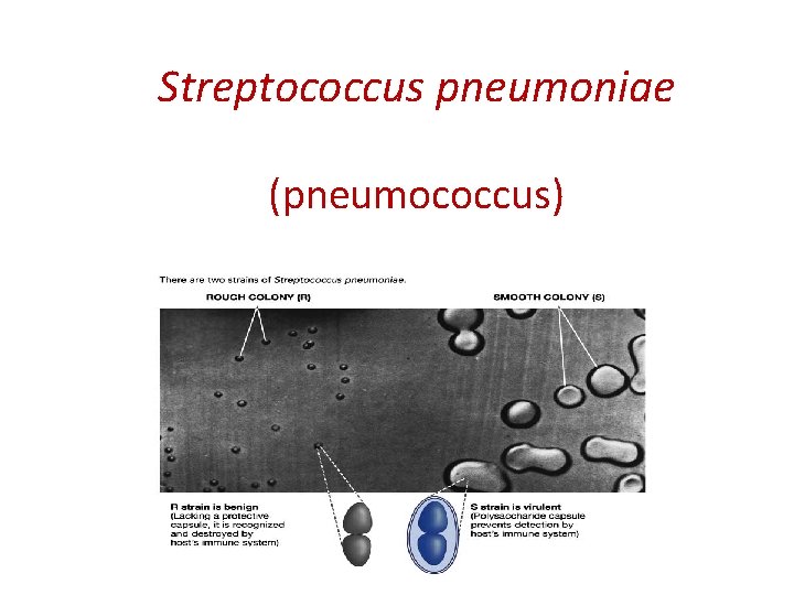 Streptococcus pneumoniae (pneumococcus) 