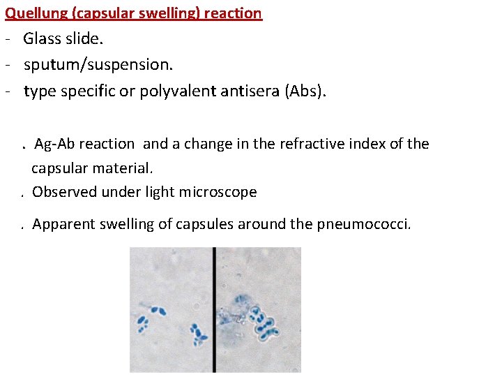 Quellung (capsular swelling) reaction - Glass slide. - sputum/suspension. - type specific or polyvalent